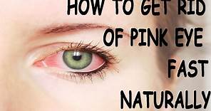 How to Get Rid of Pink Eye Fast - Conjuctivitis Treatment Naturally