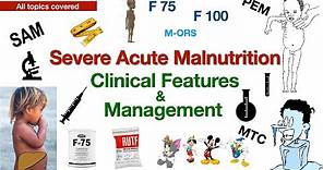 SAM | Severe Acute Malnutrition | PEM | Clinical Features | Management | Marasmus | Kwashiorkar |MTC