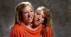 Conjoined twins Brittany and Abby Hensel respond to ‘loud' comments after Josh Bowling wedding reveal