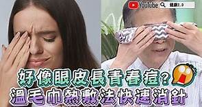 眼皮長青春痘 ？ 溫毛巾熱敷法 快速消針眼 健康2.0 精華