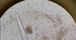 Hookworm adultworm #microbiology #parasitology #stool #microscopy