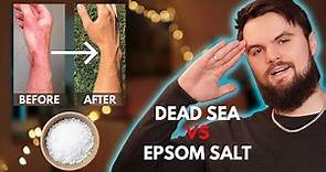 SALT WATER for the SKIN? (eczema/psoriasis/acne)