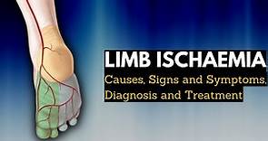 Limb Ischaemia , Causes, Signs and Symptoms, Diagnosis and Treatment.