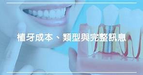 植牙完整訊息：植牙成本、類型、價格和程序步驟｜快樂牙齒 Happy Teeth