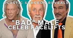 Men's Facelift Surgery: Mickey Rourke, Kenny Rogers, Burt Reynolds