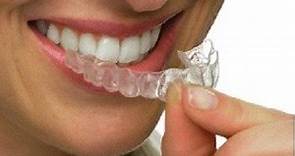 What Is Invisalign? Cost, Reviews, Before and After - Dentaly.org