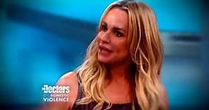 Update: Woman Whose Ex Bit Off Nose Gets Life-Changing Surgery; Real Housewife Taylor Armstrong
