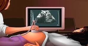 How Ultrasound Works Animation - Ultrasound Scan During Pregnancy Video - USG Medical Imaging