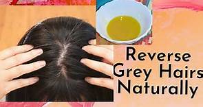 Reverse Grey Hairs Naturally | Premature Greying White Hair Treatment | Castor Oil |The Miracle Herb