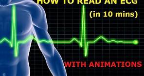 HOW TO READ AN ECG!! WITH ANIMATIONS(in 10 mins)!!