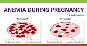 Anemia During Pregnancy, BJH Guideline