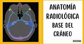 Anatomía Radiológica: Base del Cráneo.