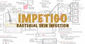Impetigo Bacterial Skin Infection - Overview (Clinical Presentation, Pathophysiology, Treatment)