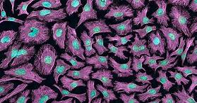What are HeLa cells? A cancer biologist explains