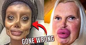 7 Times Plastic Surgery Went Horribly Wrong | Biggest Plastic Surgery Fails