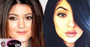 Kylie Jenner Before & After: Plastic Surgery?