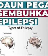 Pengobatan Epilepsi