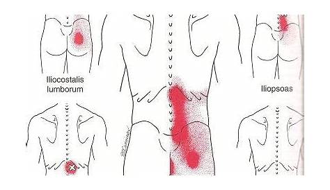 Learn about the most common low back pain trigger points and how you