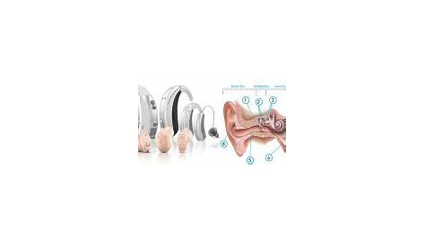 Phonak Hearing Aids : Different Models and Hearing loss products