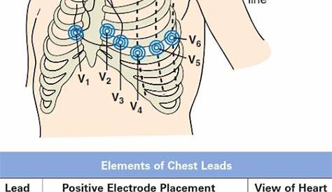 h wave electrode placement chart