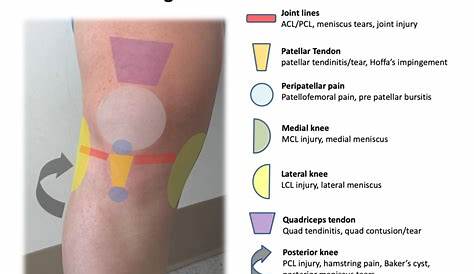 inner knee pain location chart