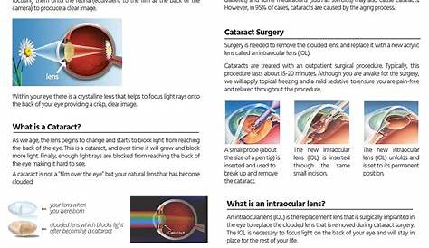 Cataract Surgery Info | reginaophthalmology