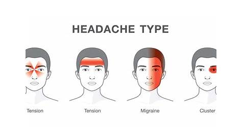 headache chart back of head
