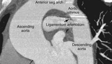 Arterial Anatomy of the Thorax | Radiology Key
