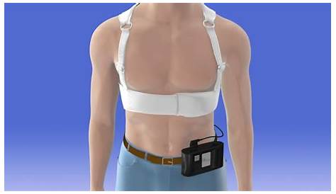 Death tied to Zoll LifeVest wearable defibrillator triggers safety
