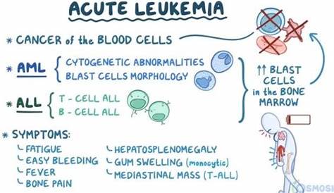 Acute and Chronic Lymphocytic Leukemia | Hematology Blueprint - Smarty