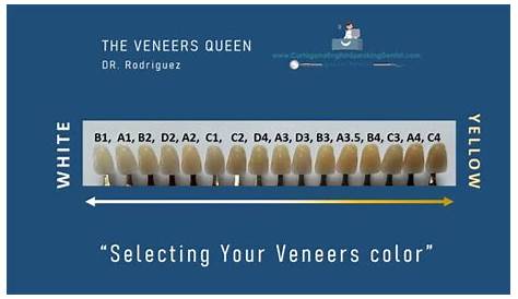 HOW TO SELECT THE RIGHT SHADE? ⋆ VENEERS - CED