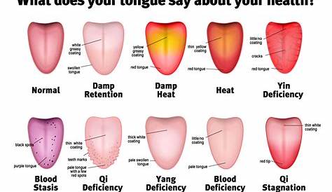 tongue-diagram - Activeherb Blog