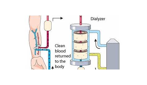 diagram of dialysis circuit
