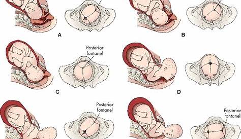 Figure 11-14 from Labor and Birth Processes Learning Objectives Key