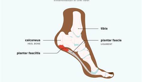 parts of heel pain