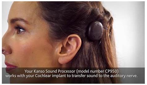 Cochlear Kanso 2 User Guide