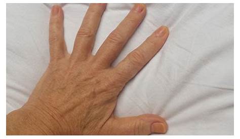 aging hands what can i do