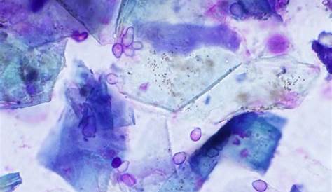 Image Gallery: Ear Cytology | Clinician's Brief