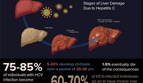 cdc hepatitis c viral load