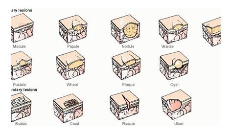 types of skin lesions chart
