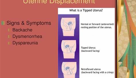 PPT - FEMALE REPRODUCTIVE DISORDERS Chapters 39 &40 PowerPoint