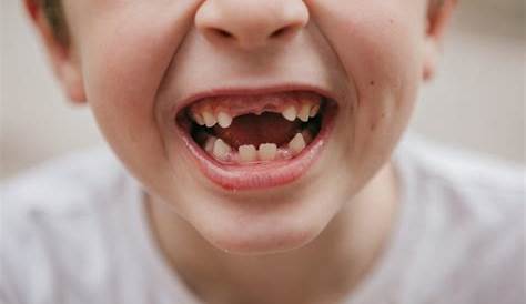 Losing baby teeth: When do they fall out and in what order? - Care.com