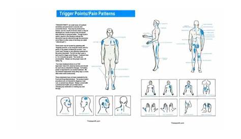Trigger Point Chart - Acupuncture Lasers.net