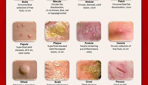types of skin lesions chart