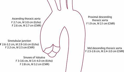 Ascending Aorta Normal Size - slidesharedocs