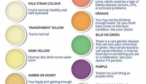 What does your urine colour mean? Brown wee could be a symptom of liver