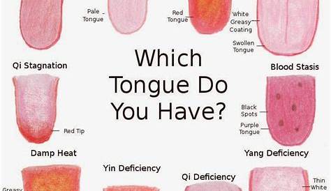 The Color Of Your Tongue Can Reveal Health Problems - TechGeek365