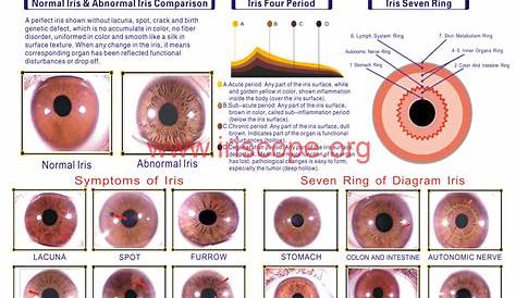 iridology chart,iridology chart left eye,iridology chart printable