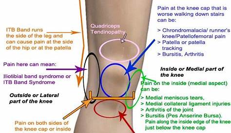 knee pain symptoms chart