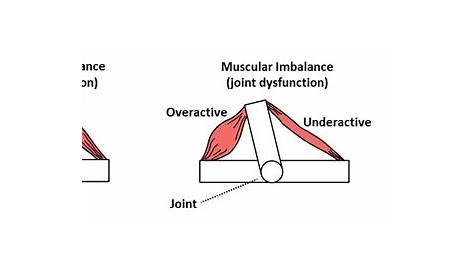 Overactive / Underactive Muscles. Everything you need to know.